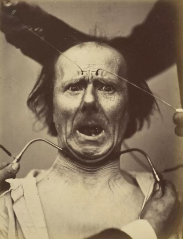 Фотографии ужасных экспериментов 1800-х годов